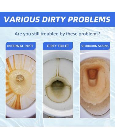 Upgrade Splash Toilet Cleaner Splash Foam Toilet Cleaner Splash Toilet Bowl Cleaner Foam Toilet bowl Cleaners Foaming Powder for Toilet Bathroom Cleaning (1pcs) - Buy Online on GoSupps.com