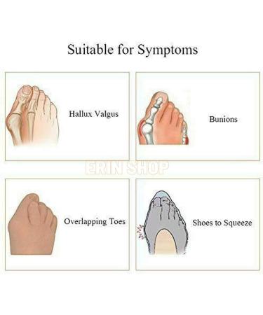 ERINSHOP Silicone Toe Separator for Overlapping & Hammer Toe Alignment - Beige - Buy Online on GoSupps.com