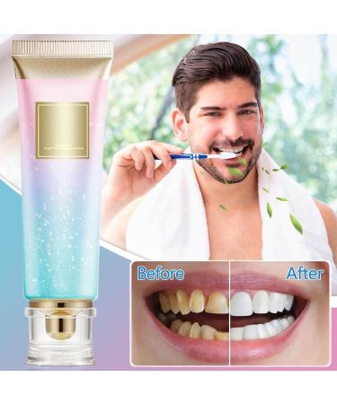 Niacinamide Whitening Toothpaste with Niacinamide 100 g Niacinamide Whitening Toothpaste Teeth Whitening Toothpaste Stain Removal and Whitening - Buy Online on GoSupps.com