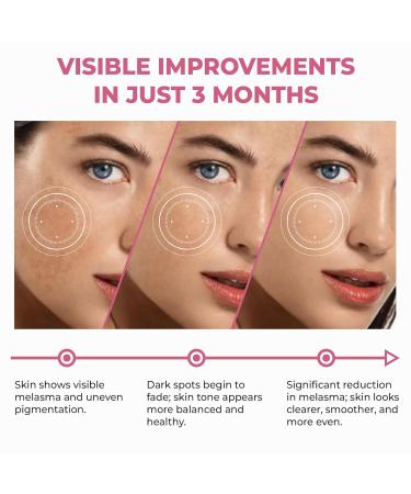 Abera Skin Renewing Serum For Melasma Anti-Aging For Face Anti-Wrinkle High Potency Saffron Extract Lavandula Stoechas Extract Hydrating Serum 1.01 Fl Oz - Buy Online on GoSupps.com