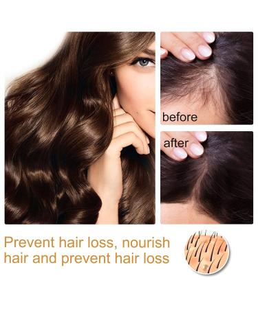 Puraect Pro Japanese Fermented Rice Water Serum for Hair Growth (2PCS) - Buy Online on GoSupps.com