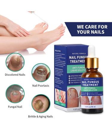 Nail Fungus Treatment - Toenail Fungus Repair Solution - Use at Home (1 Fl Oz) - Buy Online on GoSupps.com
