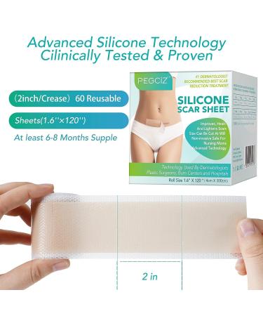 Silicone Scar Sheets - Professional Scar Removal Tape for C-Section, Surgery, Burn, Keloid, Acne - Soften and Flatten Scars - 1.6 x 120 - 3M Roll - Buy Online on GoSupps.com