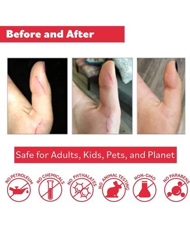 Puremedy Original Healing Ointment All Natural First Aid Salve for Wounds Burns Cuts Bug Bites Bed Sores Itching Swelling - Safe for Adults & Kids FSA - 1 oz 1 Ounce (Pack of 1) - Buy Online on GoSupps.com