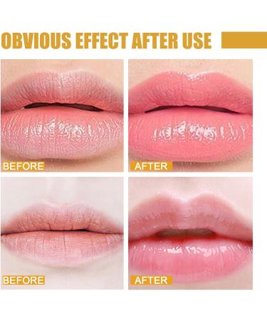 Honey Lip Care Set: Exfoliating Lip Scrub, Moisturizing Lip Balm, Sleeping Mask - Repair & Hydrate Lips, Remove Dead Skin Lines - Buy Online on GoSupps.com