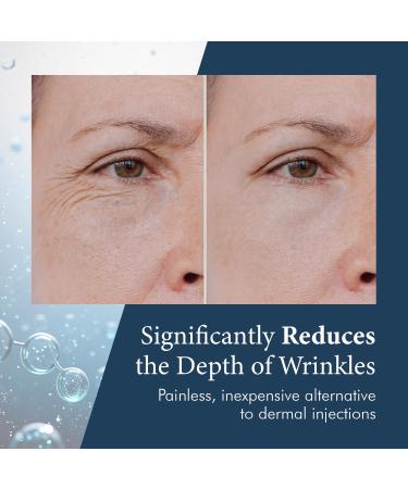 Delfogo Rx Deep Wrinkle Filler Serum | Best Anti-Aging Treatment for Fine Lines & Wrinkles - Youthful Skin Solutions - Buy Online on GoSupps.com