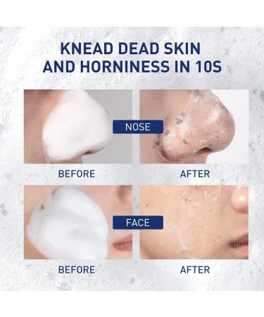 FFEEJ 2PCS Exfoliating Mousse Gentle Face Cleanser For Pore Minimizing Oil Control & Blackhead Removal - Buy Online on GoSupps.com