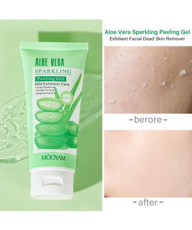Peeling Gel & Aloe Vera Exfoliator - Brightening Facial Scrub & Deep Cleansing Face Wash for All Skin Types | Remove Dead Skin & Refresh After Sun Care - Buy Online on GoSupps.com