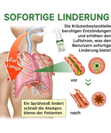 Ourlyard Herbal Lung Cleansing Spray - 5PCs Powerful Lung Support & Repair Solution for International Shipping - Buy Online on GoSupps.com