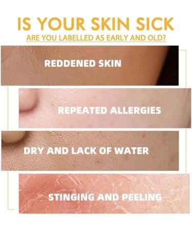 Vitamin E Oil for Face - 100% Natural Vitamin E Oil for Skin - Body Oil for Women Dry Skin - Essential Oils for Skin - Massgae Face Oil for Reduce Scars Stretchmarks 75ml - Buy Online on GoSupps.com