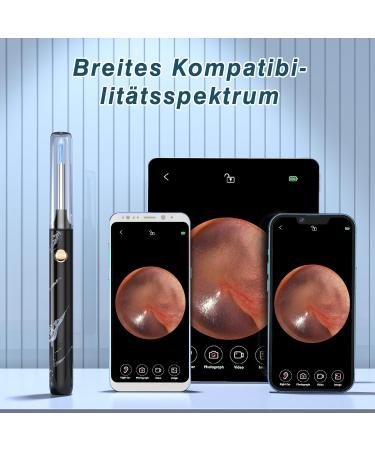 Outact 1080p HD Ear Wax Removal Otoscope - Waterproof Ear Cleaner with 7-Piece Set for iPhone iPad & Android - Perfect Ear Hygiene Solution - Buy Online on GoSupps.com