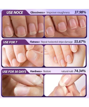 Sassytip 2 En 1 Stylo Repousse-Cuticules L'huile Sassytip Huile Cuticules Ongles Stylo Stylo Ongles 2 En 1 Pour Enlever Les Cuticules Stylo Huile De Cuticule Avec Pointe En C ramique (1PC) - Buy Online on GoSupps.com