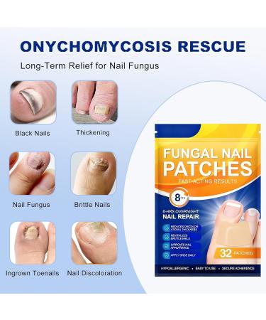 32 Pcs Patch De R paration Des Ongles De Orteils Pansements Antifongique Ongles Fungal Nail Patches Patch Traitement Mycose Ongles Pieds R paration d'Ongles Fendus R duit La D coloration - Buy Online on GoSupps.com