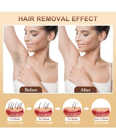 Buy Aopvui Laser Hair Removal Device - 3-in-1 IPL for Women & Men 999 900+ Flashes at-Home Hair Removal 9 Energy Levels - Buy Online on GoSupps.com