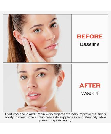 GO MAY Hydration Facial Toner FT02 - Soothing & Calming Daily Face Toner | 5 FL.OZ | International Shipping Available - Buy Online on GoSupps.com