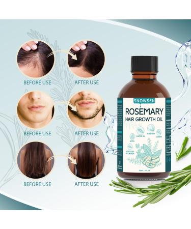 Rosemary Oil for Hair Growth - Nourishing Essential Oil Treatment for Eyebrows & Eyelashes - 4 Fl Oz Roller Bottle for Dry Split Ends & Damaged Hair - Buy Online on GoSupps.com