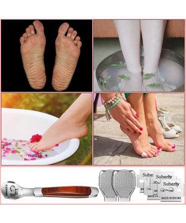 YIMART Foot Corn Removal Cutter Scraper Set - Stainless Steel Callus Remover with 10 Blades - Professional Pedicure Tool for Dead Skin and Cuticles - Buy Online on GoSupps.com