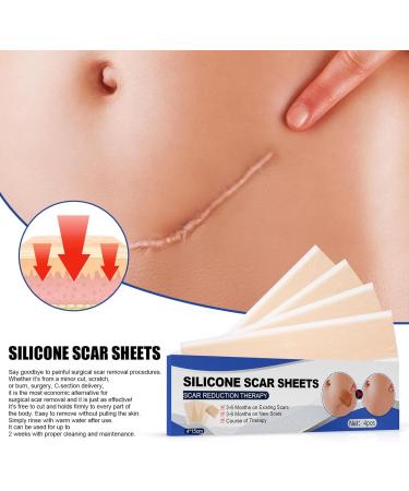 Silicone Gel Scar Patch for Fading Stretch Marks and Burn Scars - One Size - Buy Online on GoSupps.com