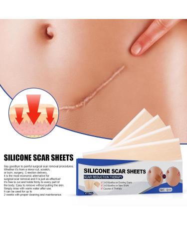 Silicone Gel Scar Patch - Fade Stretch Marks, Burns & Cuts, Smooth Skin - Tinted Face Moisturizer - One Size - Buy Online on GoSupps.com