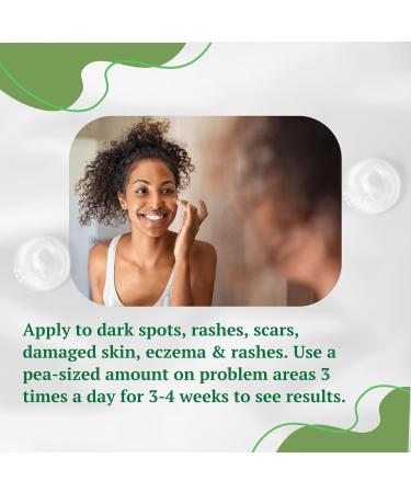 Aloe Vera Cream for Dark Spot Removal | Blemish Treatment & Scar Reducer | Face Cream for Men Women & Kids - Buy Online on GoSupps.com