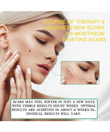 Silicone Scar Sheets - Medical Grade Removal Patches for C-Section, Surgery, Burn, Keloid, Acne - 1.6 x 60 - 1.5M - Buy Online on GoSupps.com