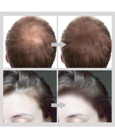 Boobeen Hairline Powder Stick - Root Touch Up for Thinning Hair, Cover Greys Instantly - Multi Contour Concealer Powder in Brown - Buy Online on GoSupps.com