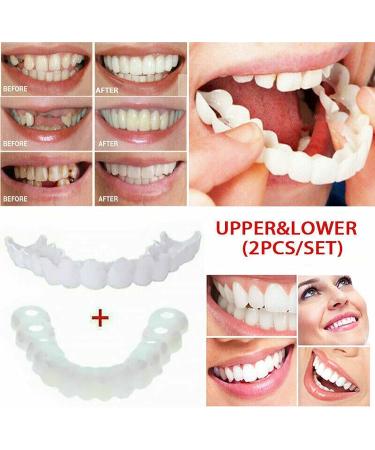 FCcassiel 2 PCS Fake Teeth Set - Upper & Lower Silica Gel Braces for Natural Shaping - Multicolor - Buy Online on GoSupps.com