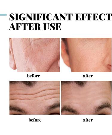 Skin Tightening Mens Crea Anti-aging Cream for Men Facial Cream Moisturiser for Men Collagen Mens Anti-Wrinkle Cream Men Face Cream Reduce Fine Lines and Wrinkles Skin Cream For Men - Buy Online on GoSupps.com