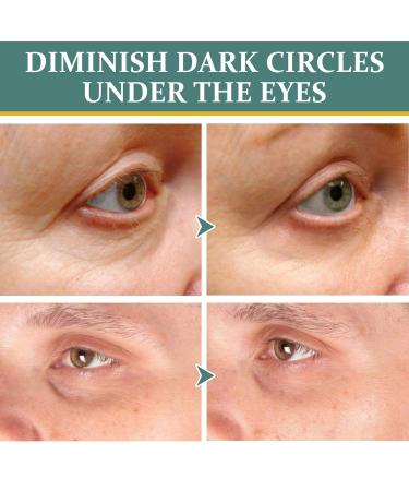 Jasmine Ointment for Dark Circles | Best Eye Cream to Remove Wrinkles & Dark Rings - 1 Piece - Buy Online on GoSupps.com