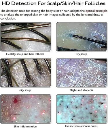 Skin Diagnosis Hair Analyzer 50X / 200X Hair Follicle Analyzer Smart Dermal Detector for Hair Follicle Test Analysis Magnifier UV Skin Analyzer - Buy Online on GoSupps.com