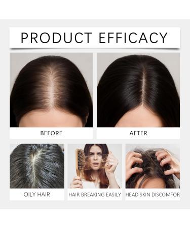  homomdy Anti Hair Loss Shampoo for Women Natural Shampoo for Hair Growth and Hair Loss Prevention Reduce Hair Breakage Soothes Scalp Nourishes and Makes - Buy Online on GoSupps.com