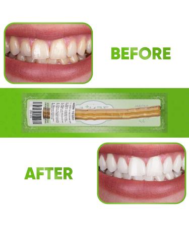 Zenia Sewak Natural Miswak Toothbrush - Traditional Peelu Stick for Healthy Gums & Teeth - Pack of 12 - Buy Online on GoSupps.com