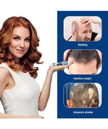 Alop cie Cr me De R paration Soin R parateur Cuir Chevelu Cheveux pais R duit La Perte De Cheveux Les Soins Du Cuir Chevelu(20gx2pcs) - Buy Online on GoSupps.com