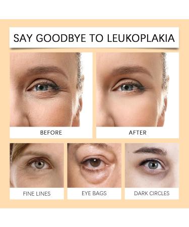 Turmeric & Retinol Eye Cream Stick Under Eye Bags Under Eye Cream for Puffiness and Bags Moisturizing Under Eye Dark Circle Balm Stick (4Pcs) - Buy Online on GoSupps.com