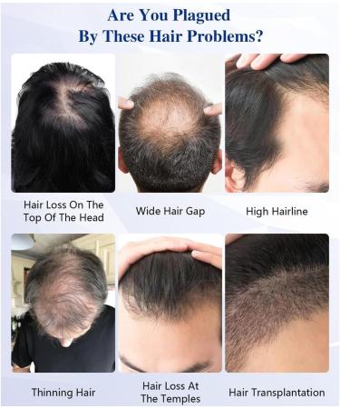 Red Light Therapy Hair Growth Cap 660Nm & 850Nm Therapy Device 82 LEDs Hair Growth for Thinning Hair Restoration of Thickness Volume - Buy Online on GoSupps.com