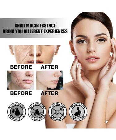 Snail Mucin Essence Snail Face Cream Anti Wrinkle Face Cream Hydrating Hyaluronic Acid Serum for Face Skin Care Day & Night Face Cream with Brightening & Lifting & Anti Wrinkle - Buy Online on GoSupps.com