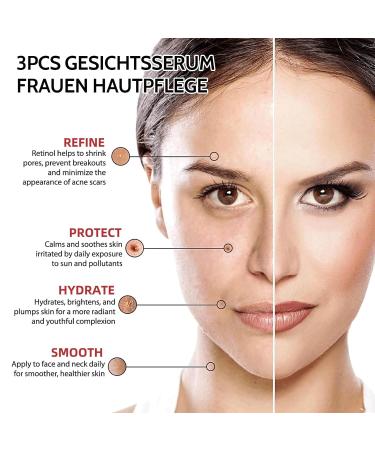 3PC Facial Serum Set for Women | Niacinamide 10% + Zinc Hyaluronic Acid 2% + B5 Retinol Serum | Acne & Pore Reduction Skincare Kits - Buy Online on GoSupps.com