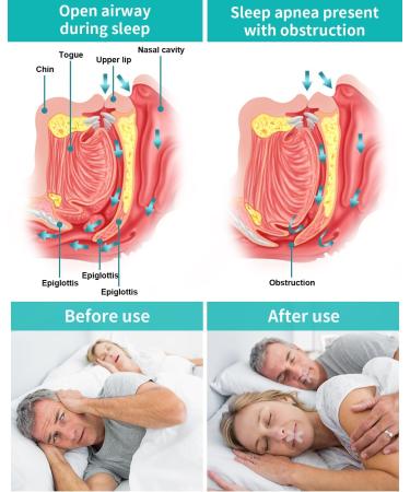 OGXCUU 120 Pcs Mouth Tape for Women - Stop Snoring & Improve Breathing | Anti Snoring Devices for Better Sleep - 120pcs - Buy Online on GoSupps.com