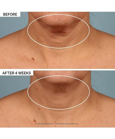 StriVectin Tighten & Lift Advanced Neck Cream Duo - Visibly Smoothing Wrinkles | Improves Skin Elasticity | Firming Treatment for Neck & Dcollet - Buy Online on GoSupps.com