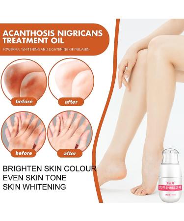 Purer Feminine Intimate Area Whitening Essence 2023 - 30ml Cream for Skin Lightening & Dark Knees/Underarms (1 PCS) - Buy Online on GoSupps.com