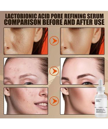Hyaluronic Acid 2%+B5 Hyaluronic Acid Serum Acid Serum Anti Aging Facial Brightening Serum Hyaluronic Acid for Face Hydrated Hyaluronic Acid Serum for Hydrated Hydraulic Acid Serum - Buy Online on GoSupps.com
