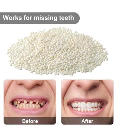 50g Tooth Solid Gel for Temporary Tooth Repair - Thermal Fitting Pearl Teeth Pellet Glue for Halloween - Fill Missing & Broken Teeth - Buy Online on GoSupps.com