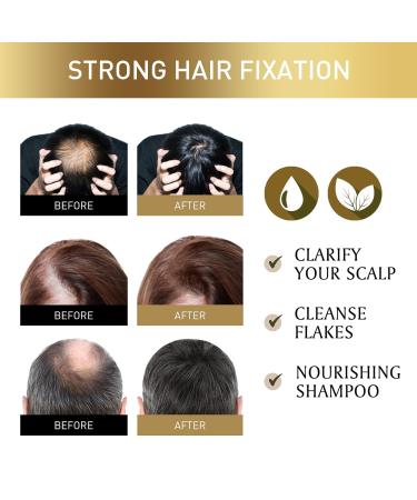 50g Hair Scalp Exfoliating Scrub Anti Hair Loss Treatment for Dandruff Flakes & Oily Scalp Nourishes Hair Follicles & Promotes Thicker Healthier Hair Growth - Buy Online on GoSupps.com
