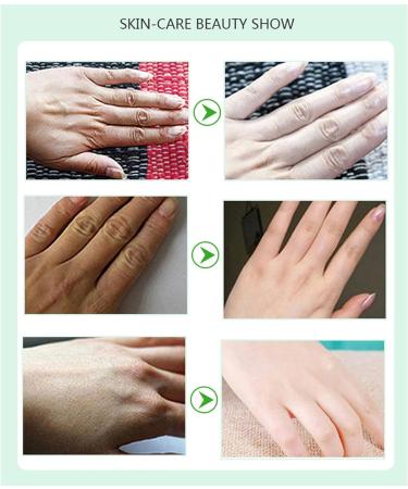 3Pcs Hand Moisturiser Gloves with Avocado Extract | Intense Hydration for Dry, Aging, and Cracked Hands | Whitening and Anti-Aging Hand Mask for Smooth, Nourished Skin - Buy Online on GoSupps.com