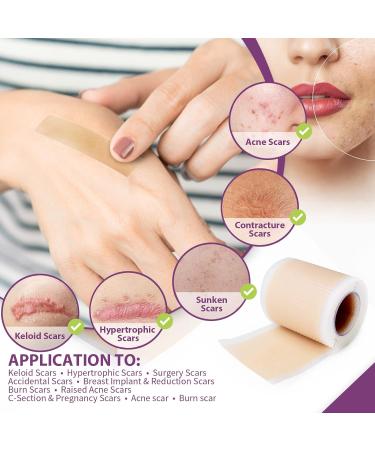 MQUPIN Silicone Scar Tape Roll (1.6 x 60 ) Silicone Scar Sheets Silicone Tape Reusable for C-Section Surgical Scar Keloid Acne Scar and Burn Scar - Buy Online on GoSupps.com