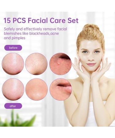 Pimple Popper Tool Kit - 15 PCS Blackhead Remover & Comedone Extractor Set with Metal Case - Buy Online on GoSupps.com