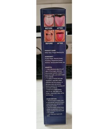 LYINUR 2PCS Tongue Cleaner Gel and Brush Kit - Fresh Mint Tongue Scrapers for Adults Oral Care - Buy Online on GoSupps.com