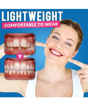 Events Bite Rail - Ultimate Bruxism Guard for Nighttime Teeth Grinding & Protection | Memory Case Included - Buy Online on GoSupps.com