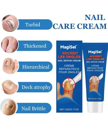 Cr me de Soin des Ongles Emollient Ongle Soin-Ongles Des Pieds Nourrissant et Renforce pour Ongles R paration D ongle Pour Les Ongle D color s paissis miett s Cass s 20g - Buy Online on GoSupps.com
