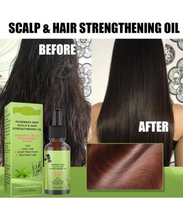 Rosemary Mint Scalp & Hair Strengthening Oil 59ml Rosemary Hair Growth Oil Rosemary Oil for Hair Growth Anti Hair Loss Fast Grow Nourish Dry Damaged Hair for Men & Women (2 pieces) - Buy Online on GoSupps.com
